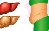 Lūk, kā ķermenis tevi cenšas brīdināt – pazīmes, kas liecina, ka tev ir aknu problēmas Lūk, kā ķermenis tevi cenšas brīdināt – pazīmes, kas liecina, ka tev ir aknu problēmas