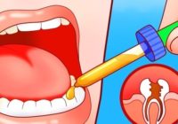 Sāp zobs, bet līdz zobārsta apmeklējumam vēl tālu? Dabīgs līdzeklis, kas noņems zobu sāpes