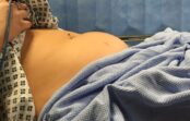 Viņa 9 dienas aizmirsa izņemt higiēnisko tamponu – lūk, kas notika Viņa 9 dienas aizmirsa izņemt higiēnisko tamponu – lūk, kas notika
