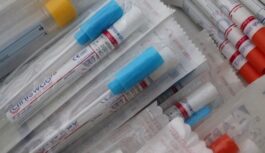 Vienā no Latvijas slimnīcām konstatēts Covid-19 vīrusa jaunais paveids Vienā no Latvijas slimnīcām konstatēts Covid-19 vīrusa jaunais paveids